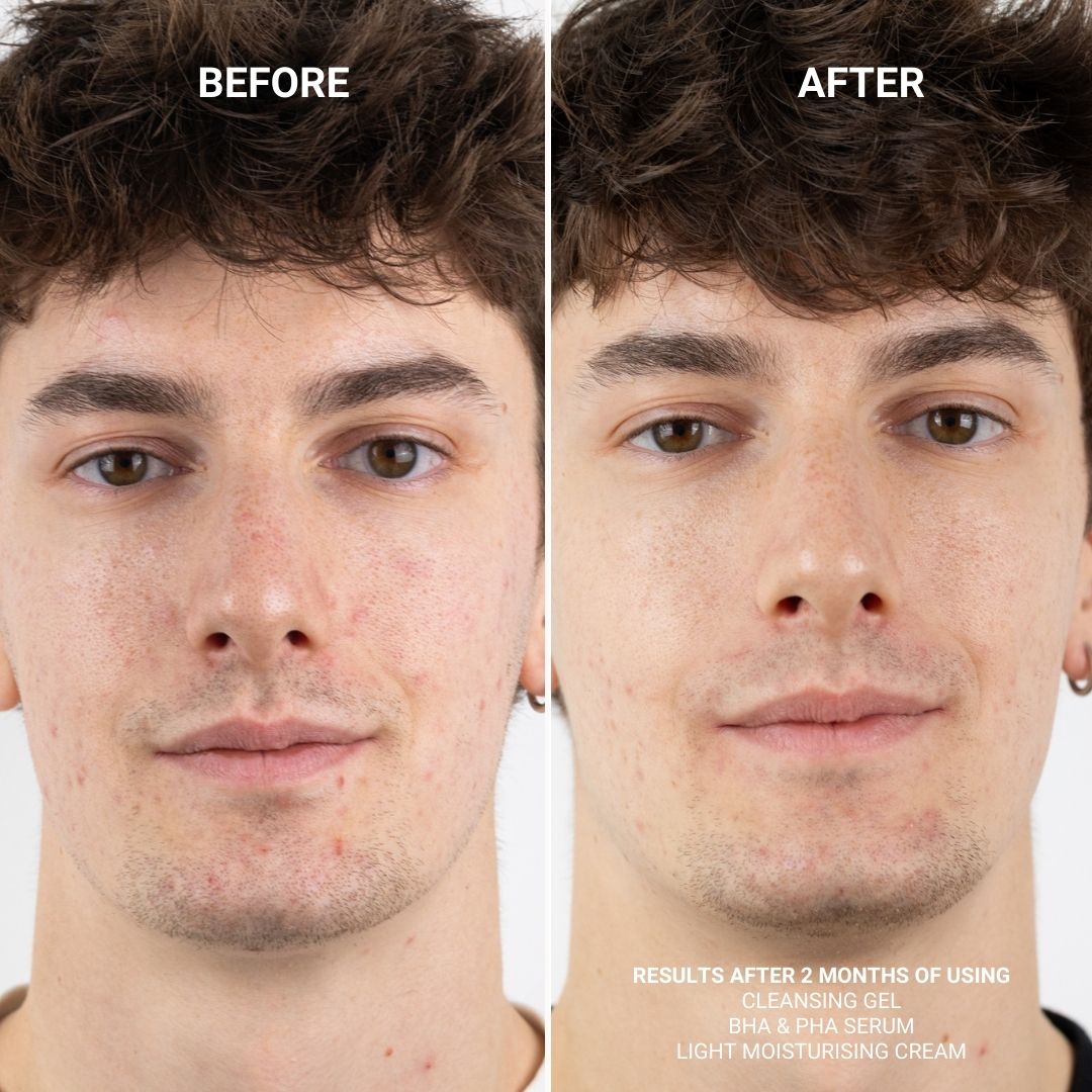 PAKKE: CLEANSING GEL + BHA/PHA SERUM