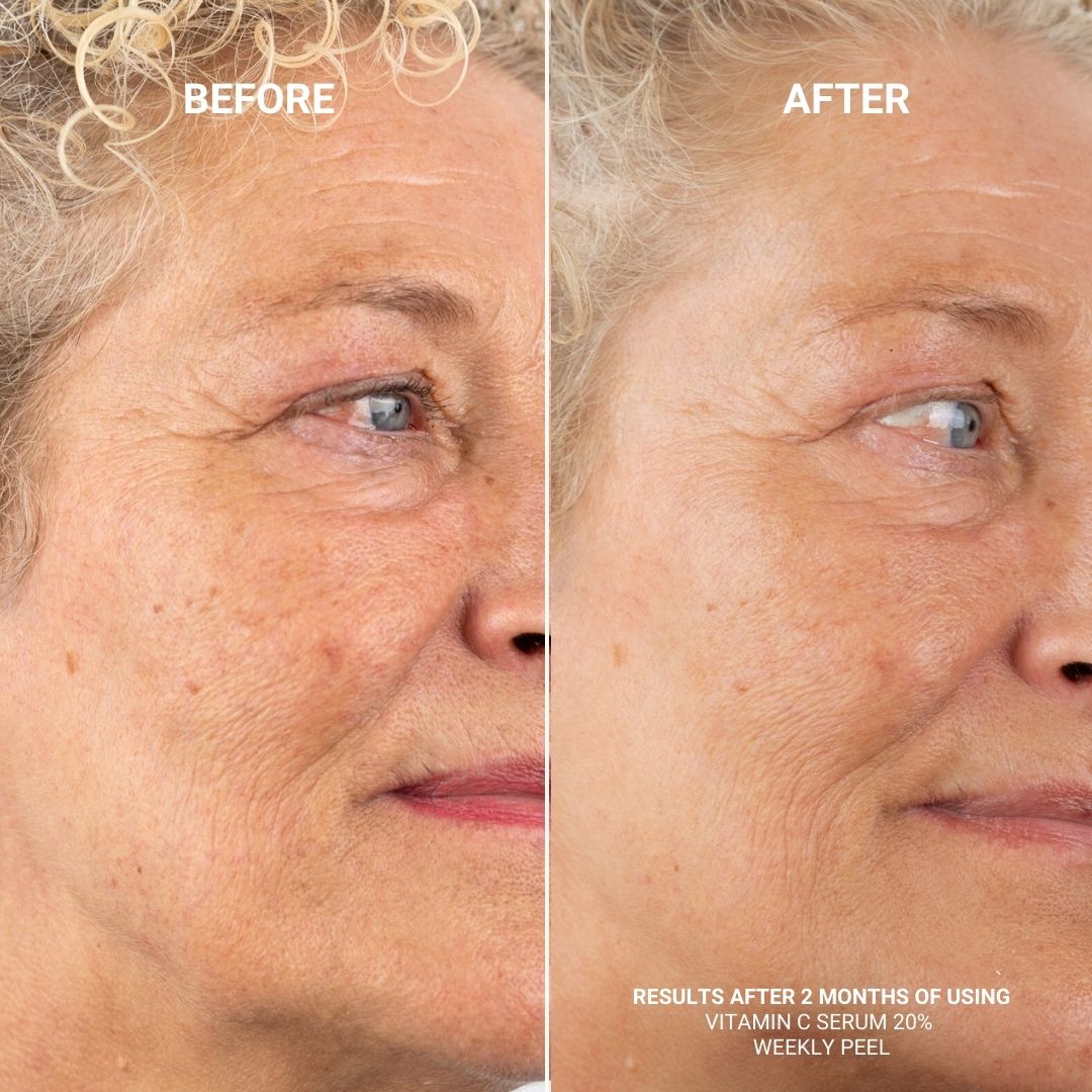 PAKKE: VITAMIN C SERUM 20% + WEEKLY PEEL