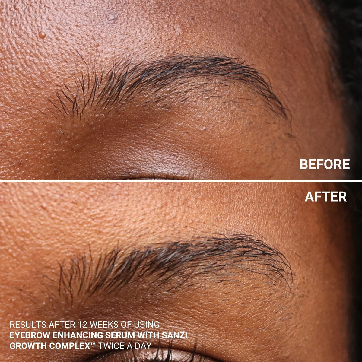 EYEBROW ENHANCING SERUM WITH SANZI GROWTH COMPLEX™
